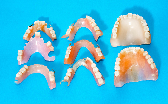活动假牙的寿命是多久 使用假牙莫忽视五点