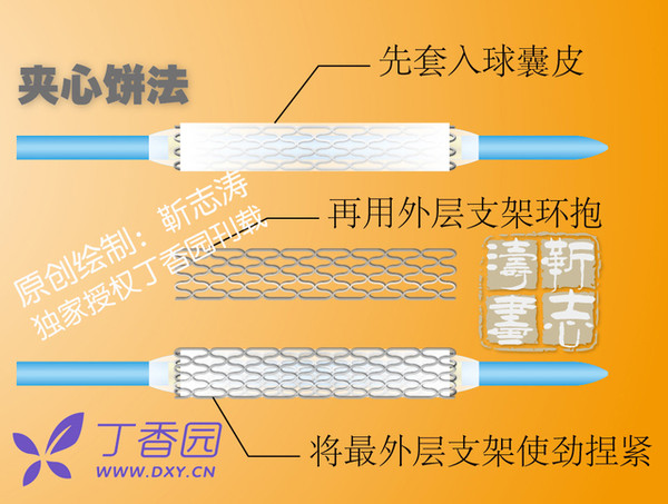 修理手机支架游戏-年轻人的最爱！手机支架游戏维修大揭秘