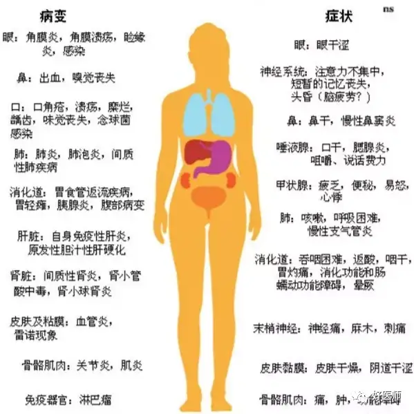 蓬发综合征_蓬发综合征症状_蓬发综合征怎么治疗