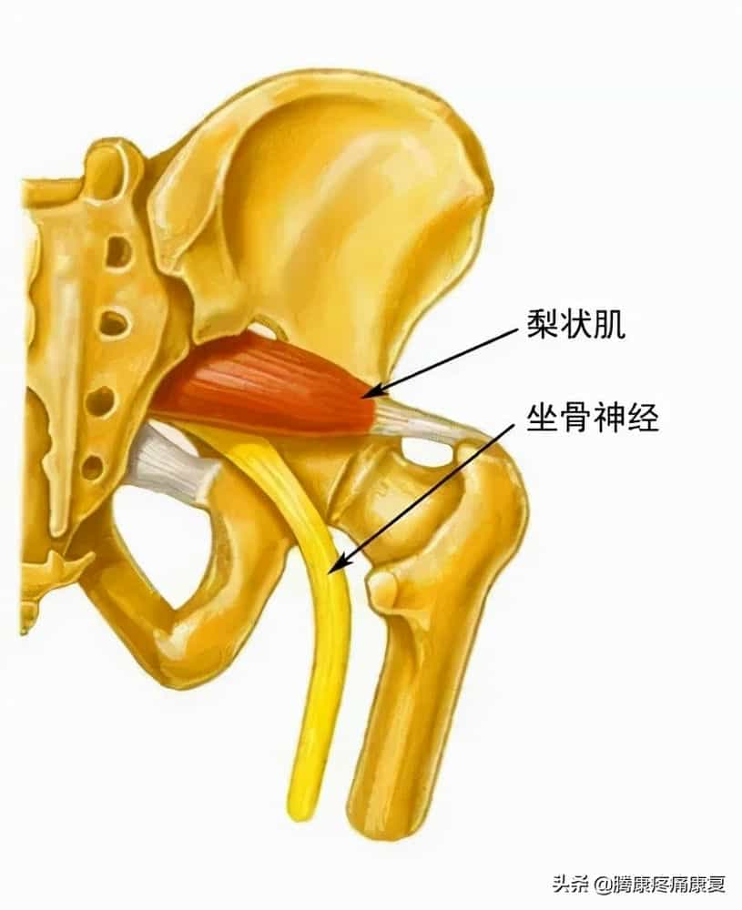 蓬发综合征怎么治疗_蓬发综合征症状_蓬发综合征