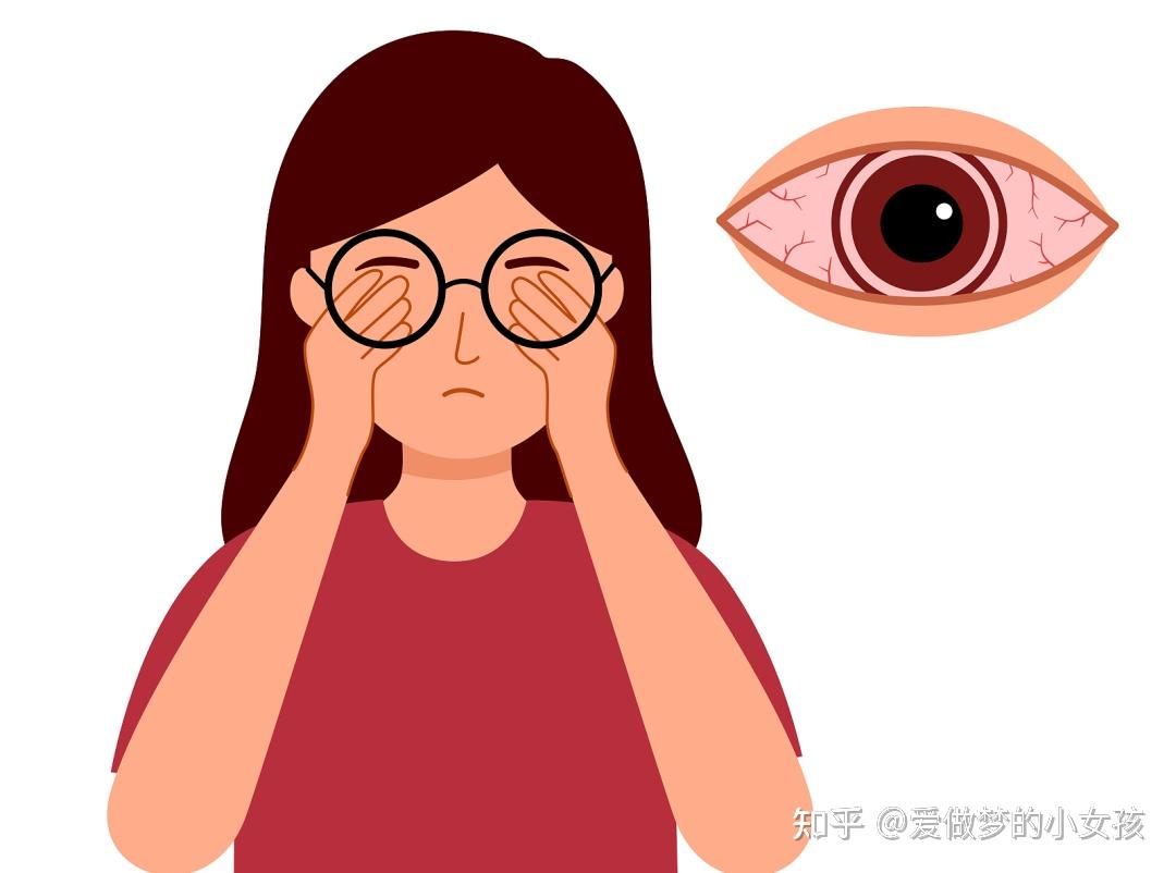玩游戏看手机眼睛疼怎么办_眼睛疼看手机眼睛疼怎么回事_玩手机眼睛痛了玩电脑就不痛