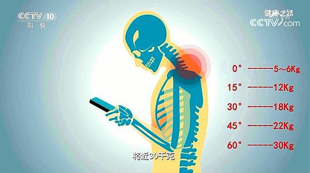 颈椎病玩得手机游戏会头晕吗_颈椎病玩得手机游戏会怎么样_玩手机游戏得了颈椎病